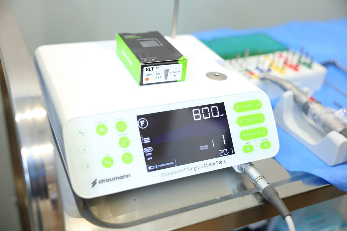 インプランター