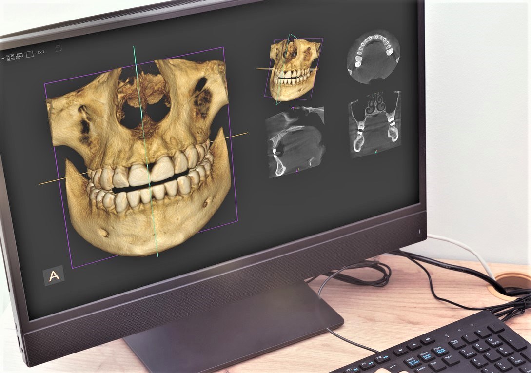 精密検査による根拠ある診断
