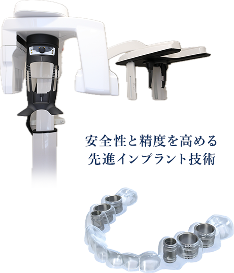 安全性と精度を高める先進インプラント技術