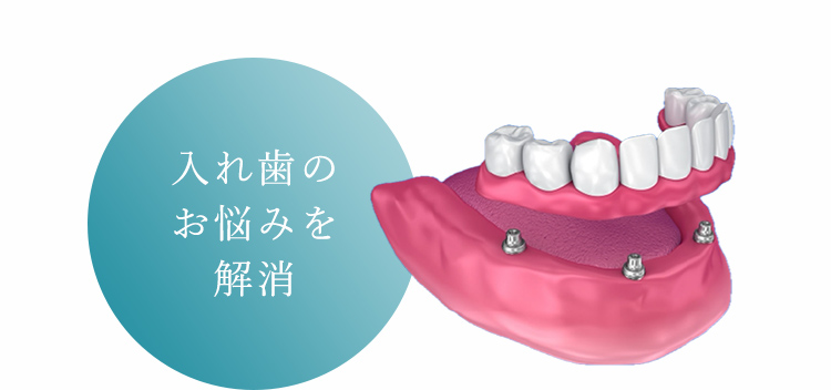 入れ歯のお悩みを解消