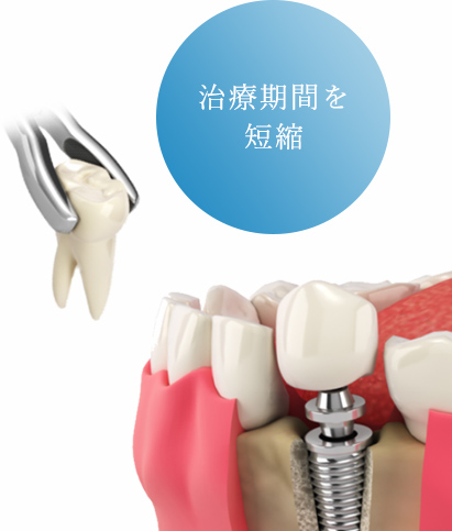 治療期間を短縮