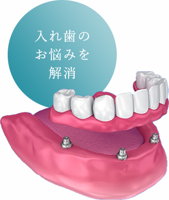 入れ歯のお悩みを解消
